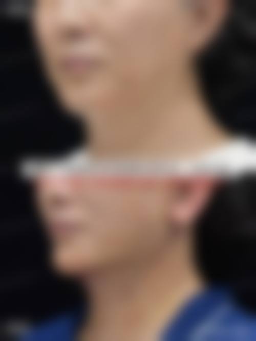 河间市丽达医疗美容诊所价格表（仅供参考）