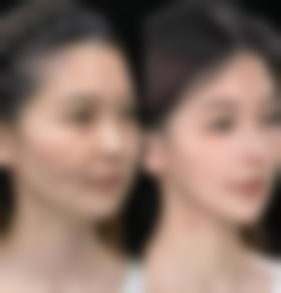 成都高新童颜博仕仕整形医院价格表（仅供参考）