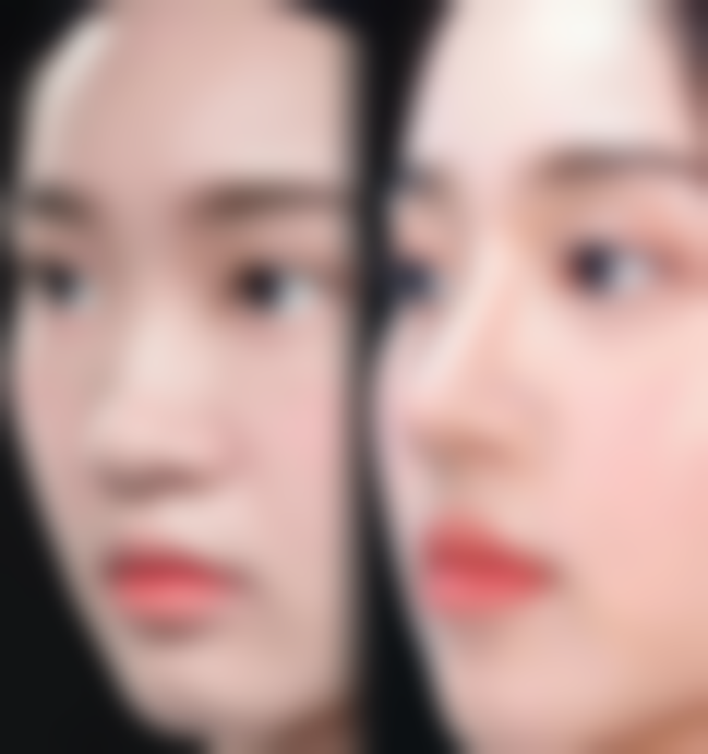 新疆医 科 大学第五附属医院整形美容科怎么预约？