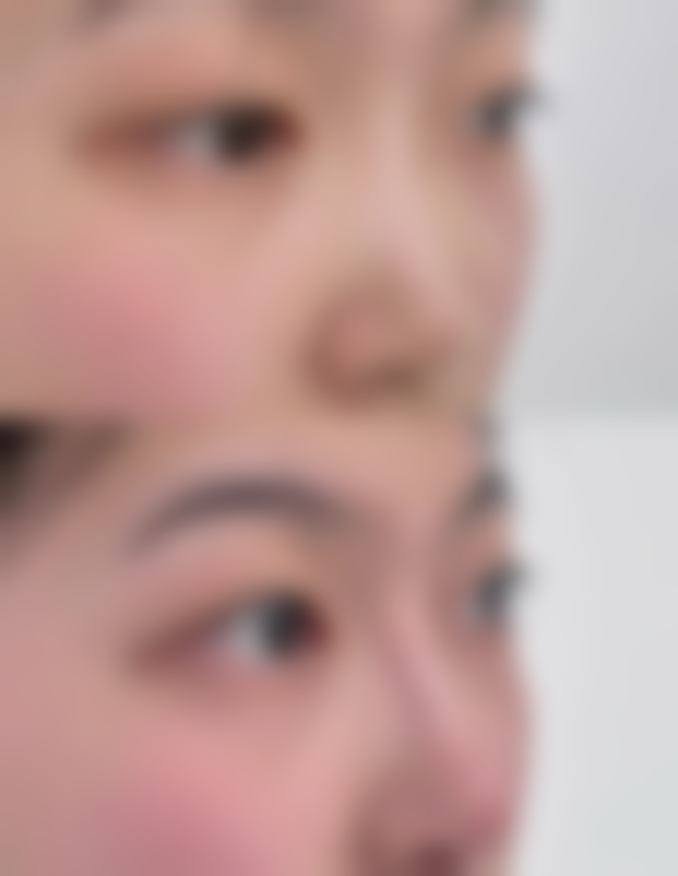 新疆医 科 大学第五附属医院整形美容科价格表（仅供参考）