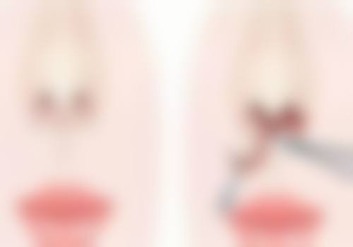 十堰民生医学整形实例参考