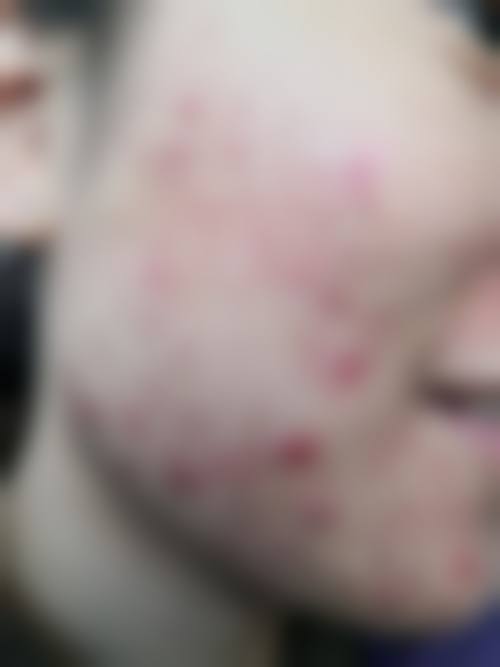 嘉鱼县人民医院皮肤性病美容专科门诊团队技术标准