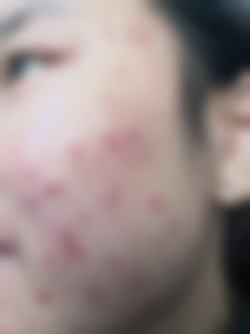 嘉鱼县人民医院皮肤性病美容专科门诊擅长项目