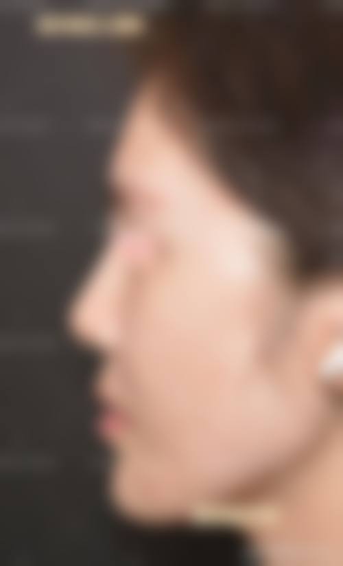 嘉鱼县人民医院皮肤性病美容专科门诊实例参考