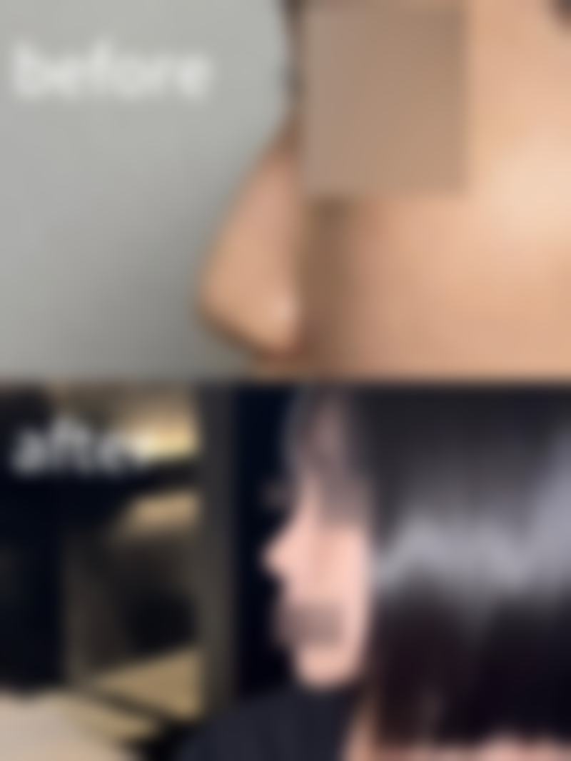 十堰民生医学整形价格表（仅供参考）