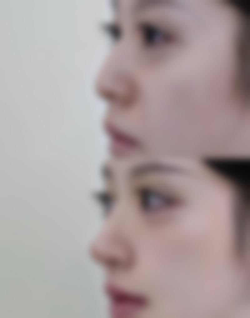 十堰民生医学整形交通指南