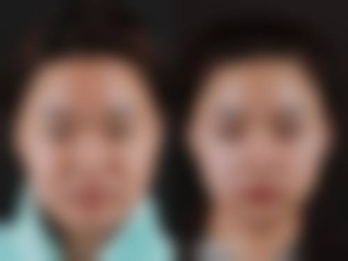 沈阳艾薇医疗美容价格表（仅供参考）