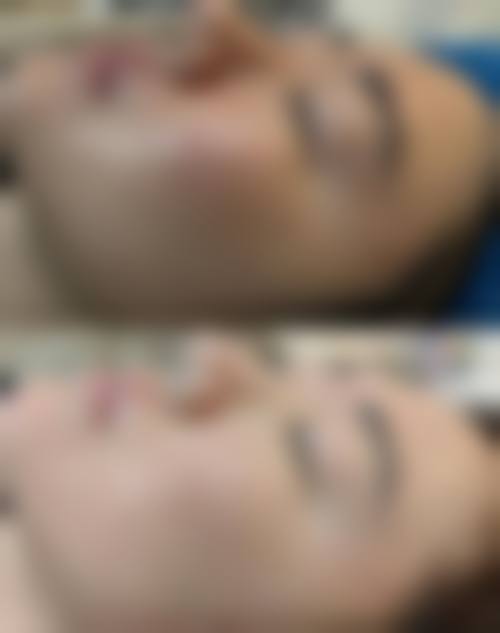 云南昆明铜雀台美容整形医院实例参考