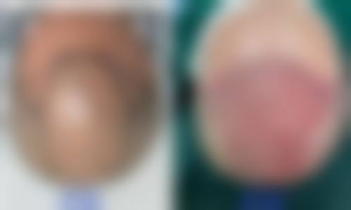 重庆医科大学附属第一医院整形美容科交通指引