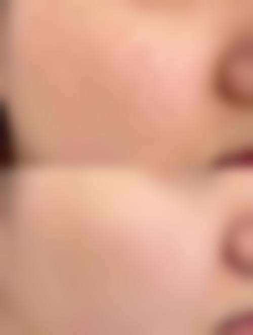 河北沧州蓝途医疗美容门诊部价格表（仅供参考）