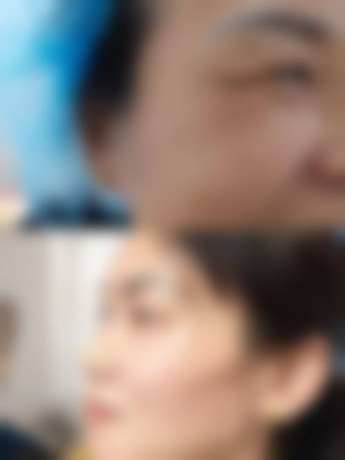 云南昆明铜雀台美容整形医院价格表（仅供参考）