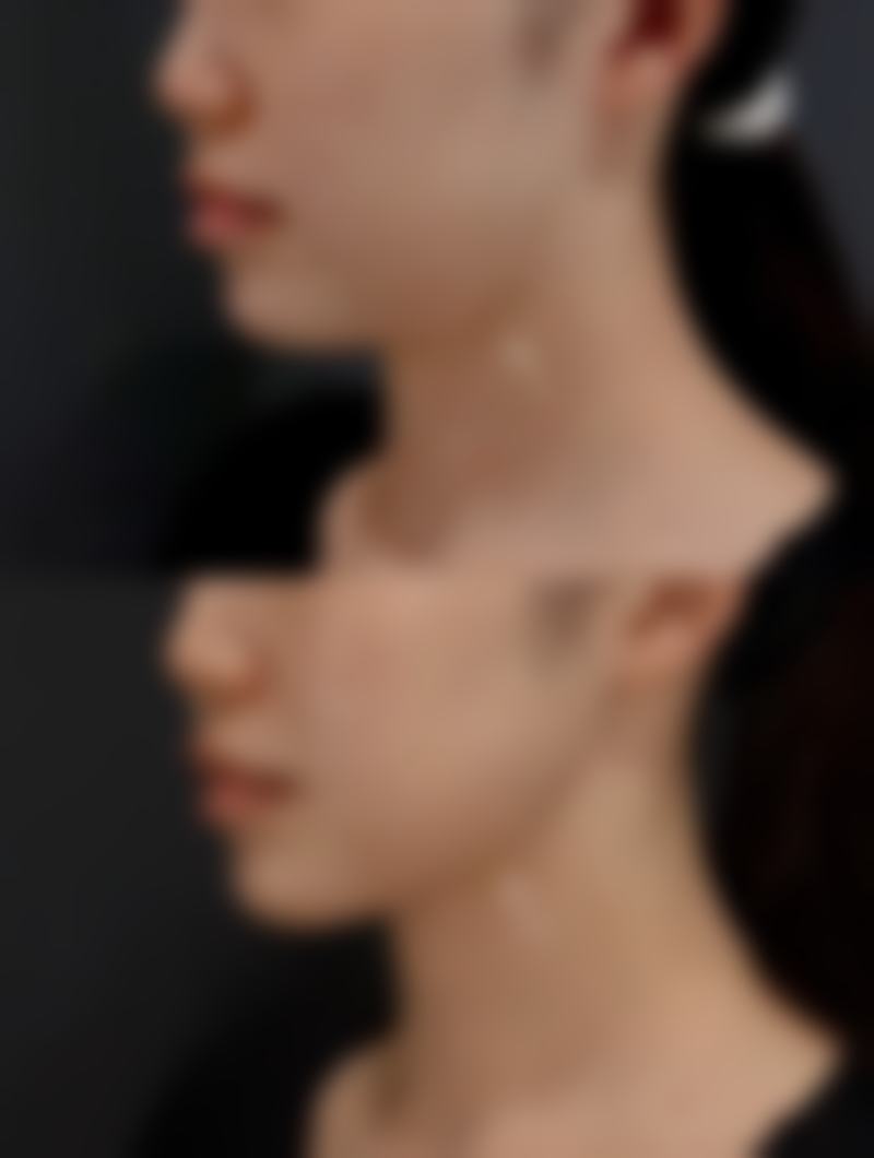 沈阳艾薇医疗美容擅长项目