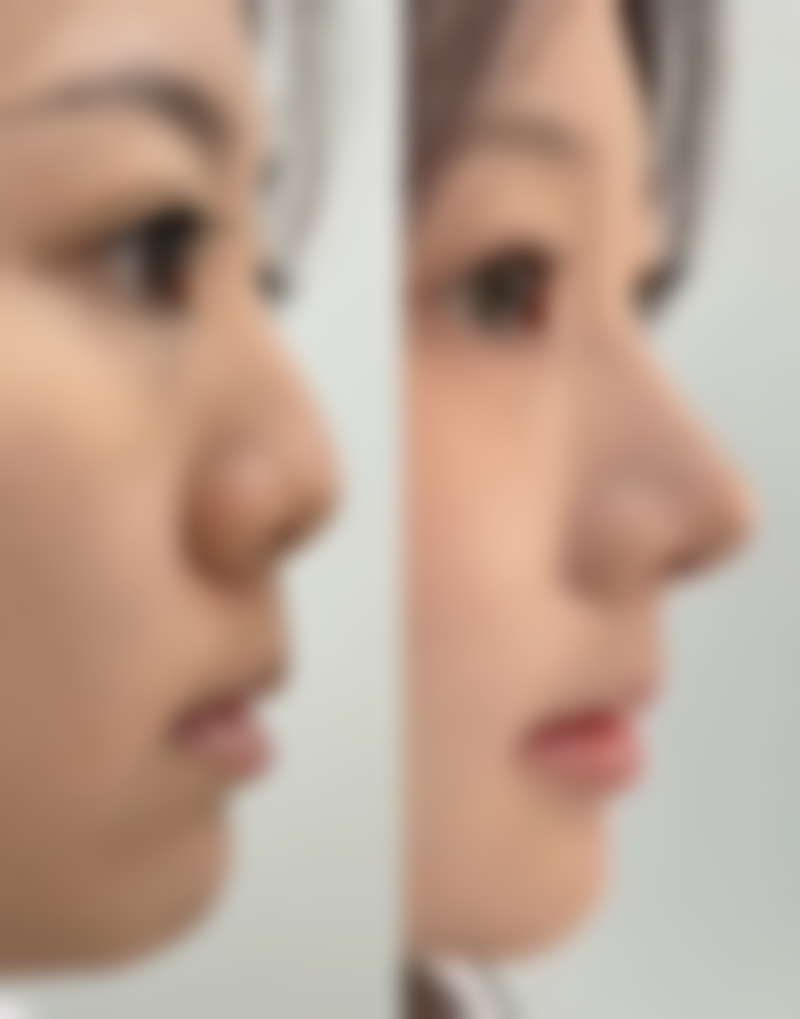 上海吴坤南医疗美容诊所价格表（仅供参考）