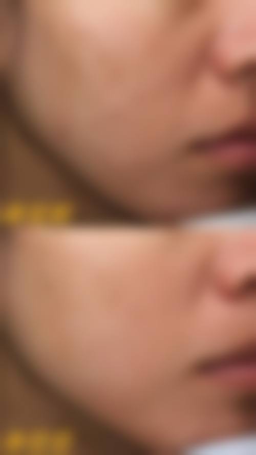 北医三院成形外科整形美容中 心擅长项目