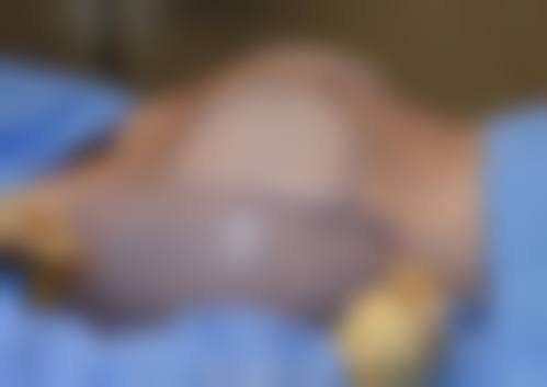 莱州市慢性病防治院医疗美容中 心怎么预约？