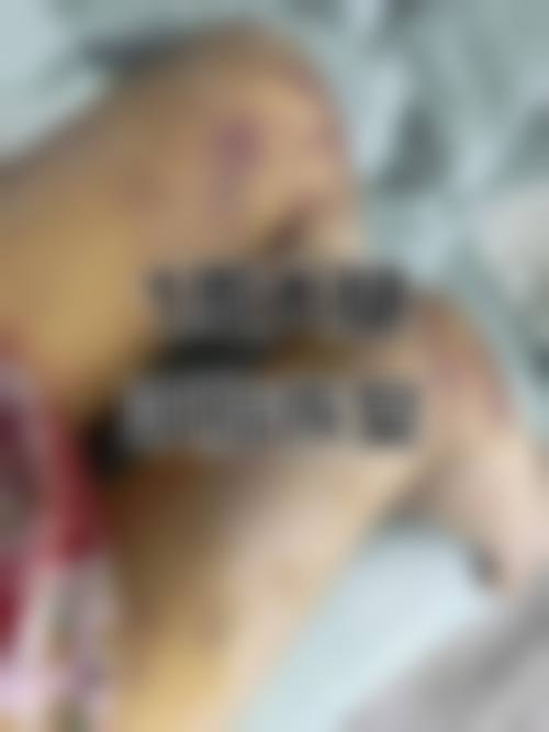 深圳熹尔整形医院怎么预约？