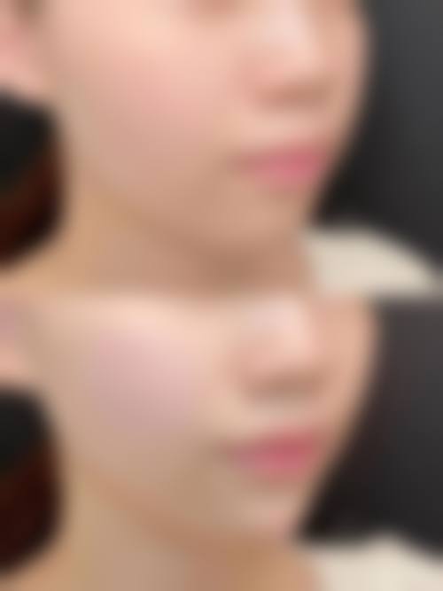 曲靖韩方科颜医疗美容门诊部实例参考