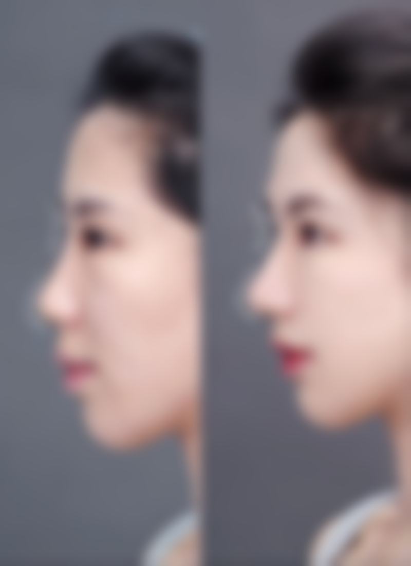 上海美之源整形外科医院价格表（仅供参考）