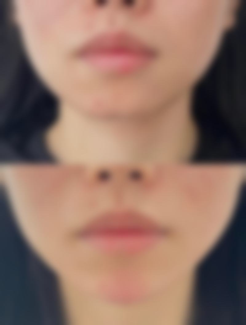 曲靖韩方科颜医疗美容门诊部怎么预约？