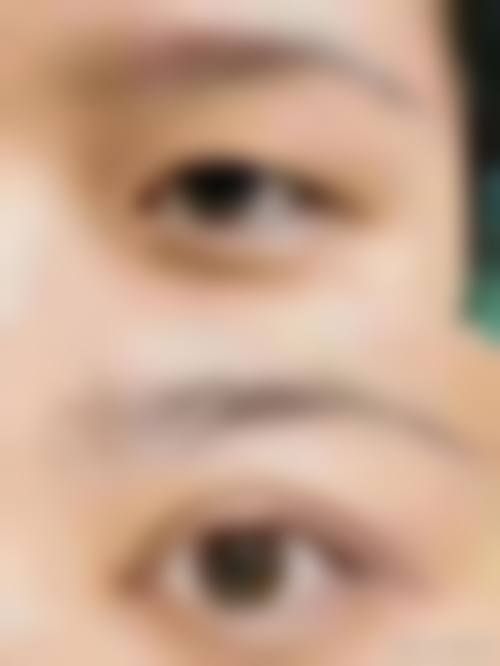 六盘水利美康整形医院怎么预约？