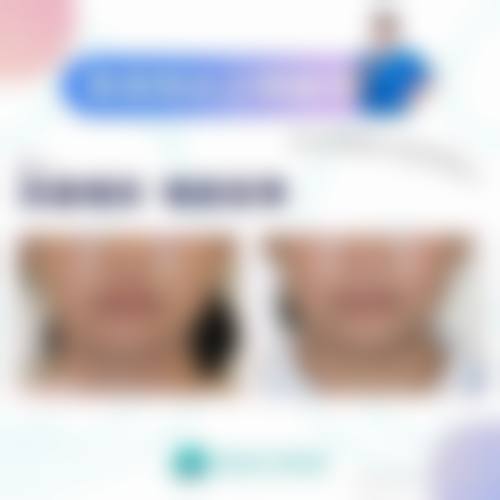 铁岭恒韵医学美容诊所实例参考