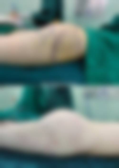 大同华懿倾城医疗美容诊所实例参考