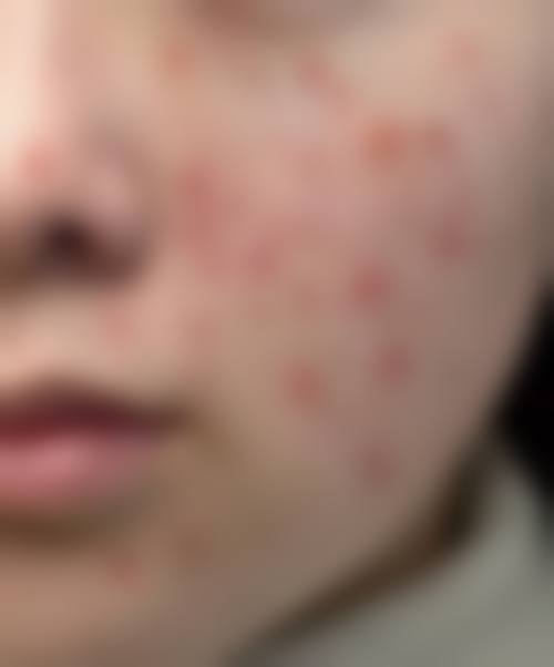 海口美兰莱可美美容店怎么预约？
