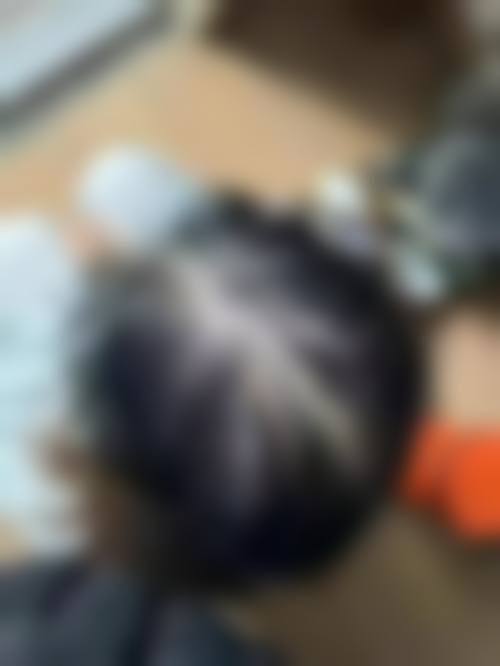 重庆高新新沐植发医院擅长项目