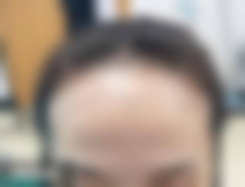 重庆高新新沐植发医院价格表（仅供参考）
