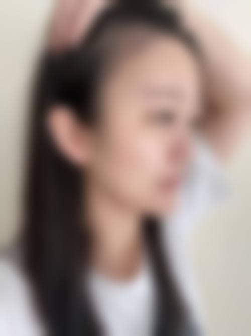 北京焕誉整形医院擅长项目