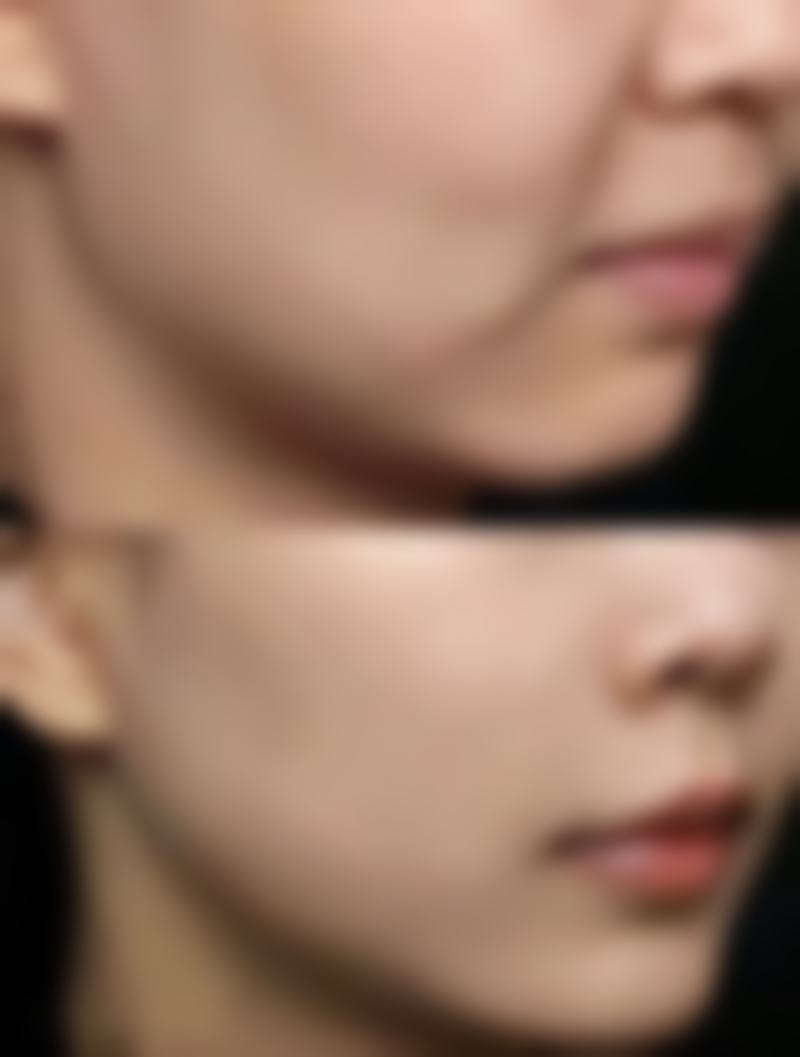 林京首患者评价