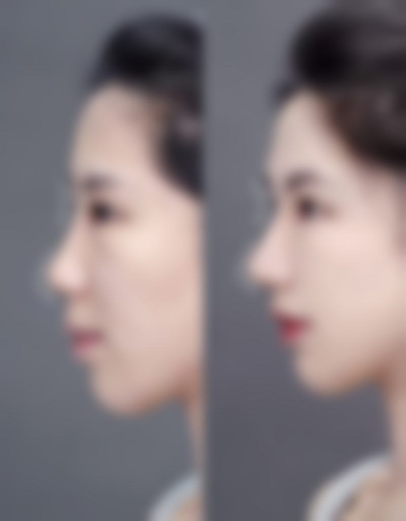 李世碧荣誉