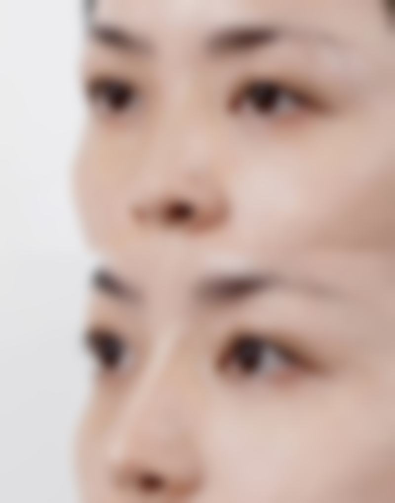 南宁美初医疗美容门诊部地址及到院路线
