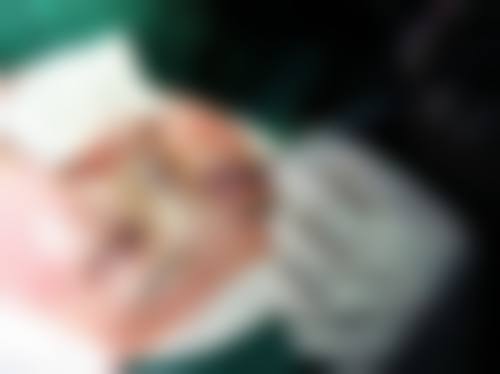广州医和你整形医院实例参考