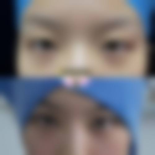深圳韩秀玉颜玺整形医院怎么预约？