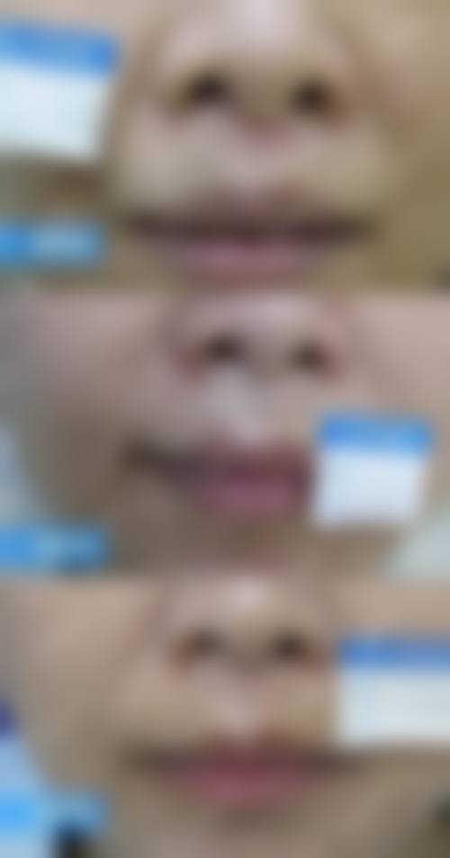 辽阳晟颜医疗美容门诊部实例参考