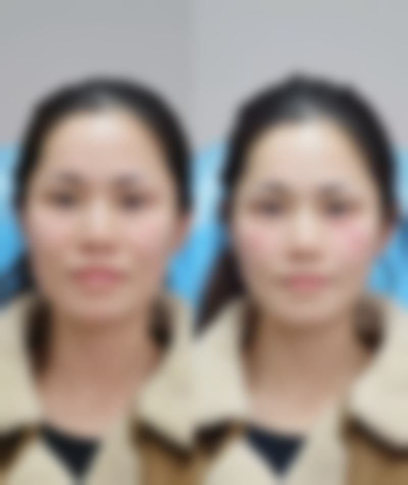 熊名田擅长项目列表