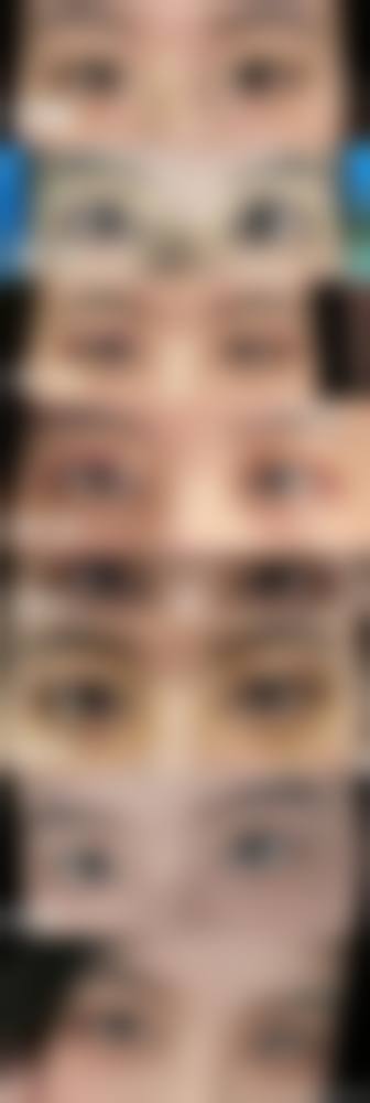 湖南长沙唯姿奥拉克整形医疗美容（长沙店）实例参考
