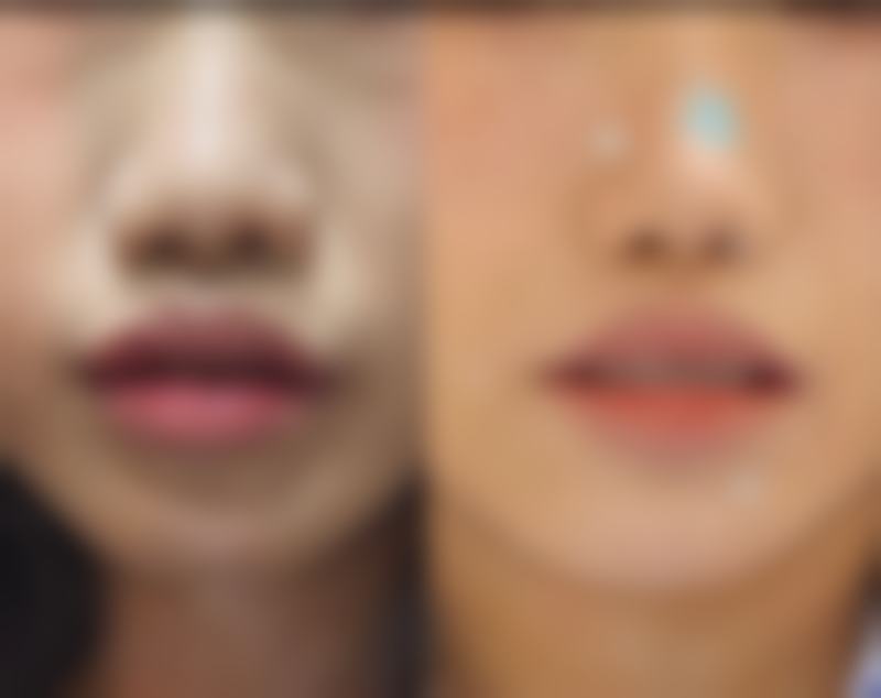 成都达芬奇医疗美容实例参考