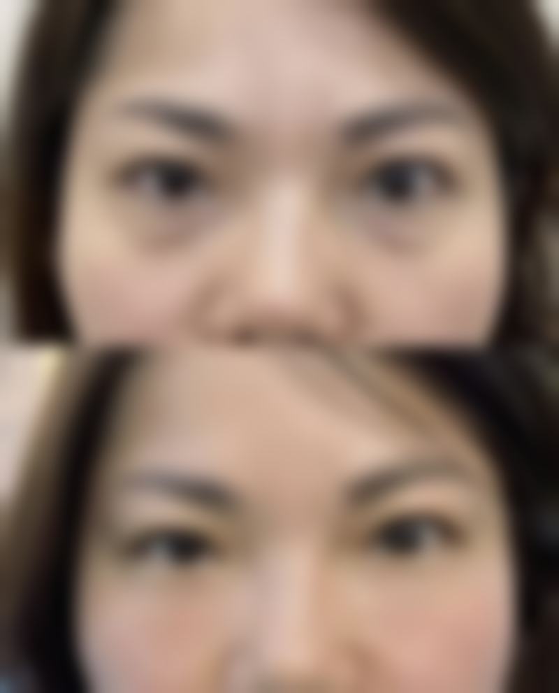 深圳享美瑞尼丝医疗美容诊所实例参考