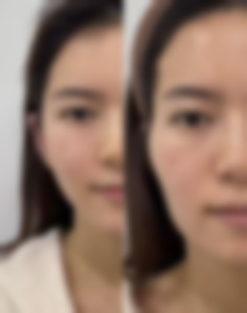 鲁权患者评价