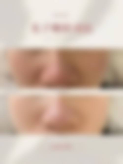 三台县婉韵美医疗美容诊所擅长项目
