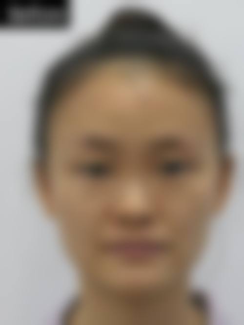 赣州星铂丽医疗美容门诊部擅长项目