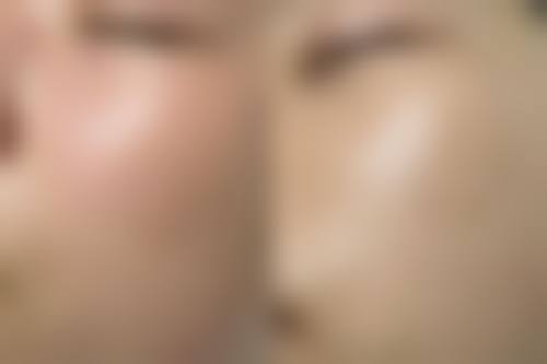 佛山禅城叶玉红整形医院怎么预约？