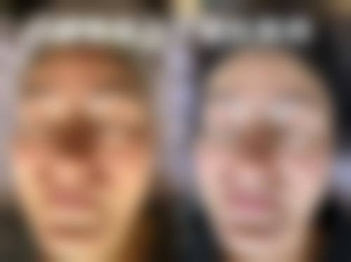 汕头陈静医学整形美容实例参考