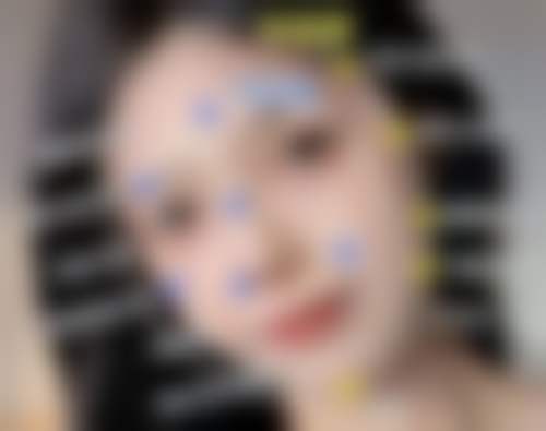 四川省人民医院整形外科实例参考