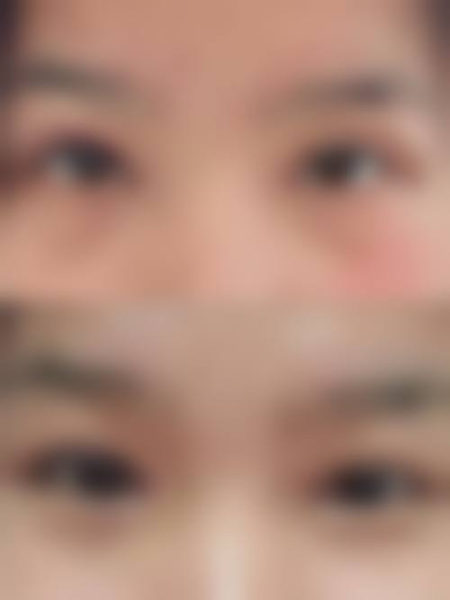 西安博医整形美容门诊部价格表（仅供参考）