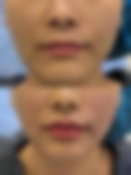 湛江市名媛医疗美容怎么预约？