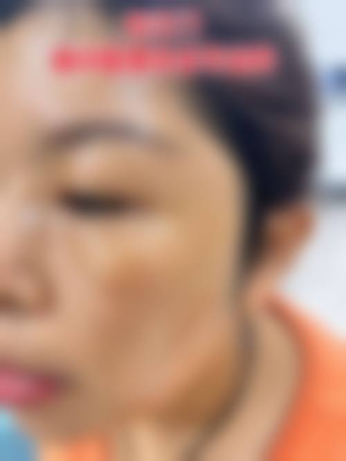 湛江市名媛医疗美容实例参考