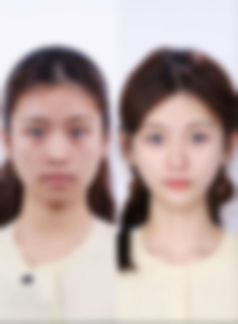 童飞擅长项目列表